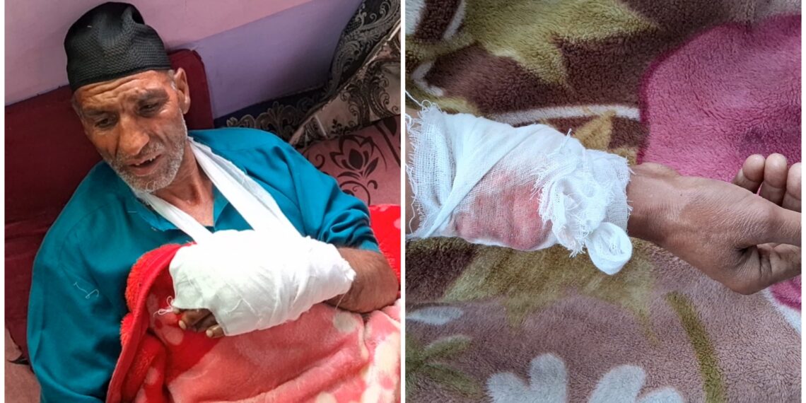 Stray Dog Creates Panic in Padgampora Awantipora, Injures Some Residents