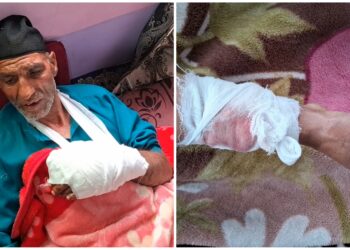 Stray Dog Creates Panic in Padgampora Awantipora, Injures Some Residents