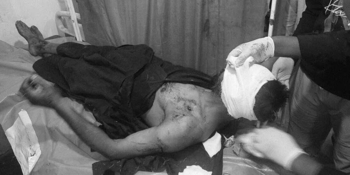 Bear Attack Injures Man in Lam Tral; Locals Demand Shifting of Segregation Shed
