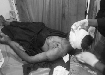 Bear Attack Injures Man in Lam Tral; Locals Demand Shifting of Segregation Shed